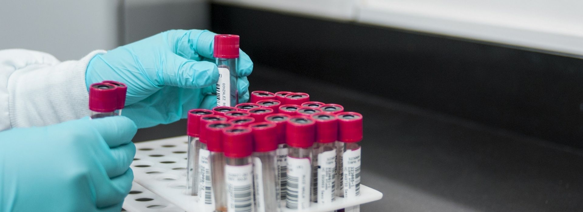 Tüp Bebek Tedavisinde Yapılan Tahliller