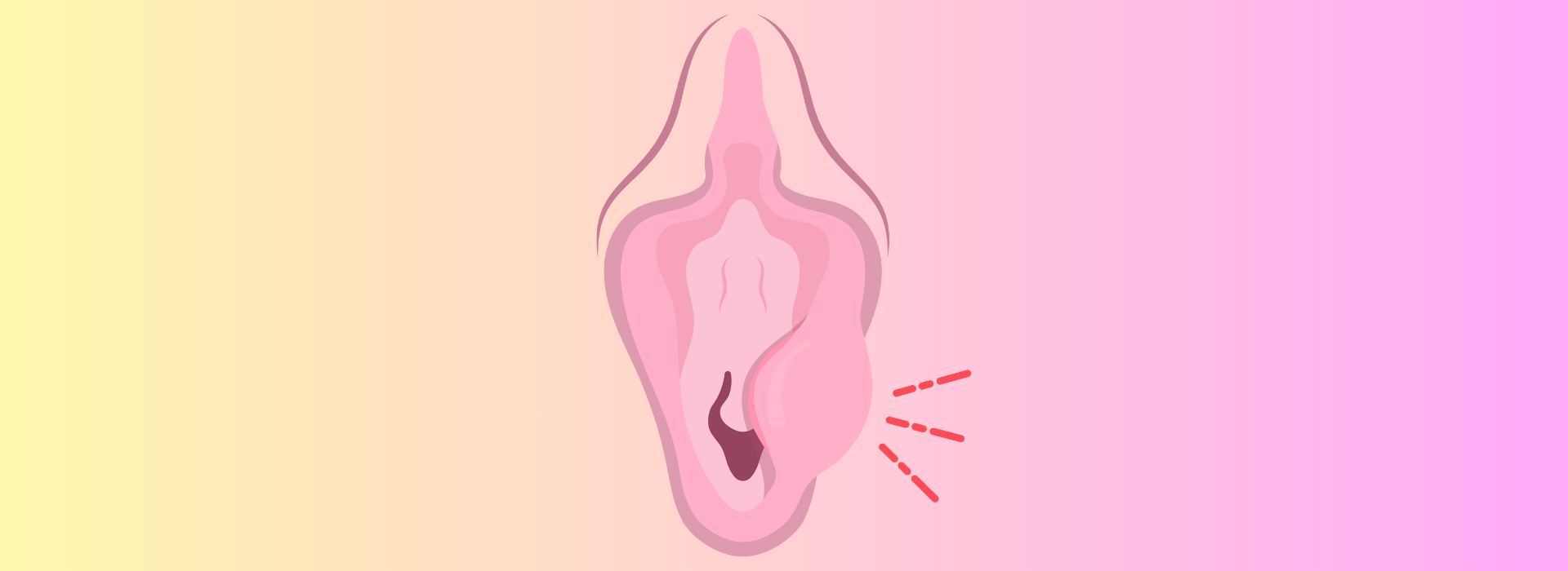Bartholin Kisti Nedir?