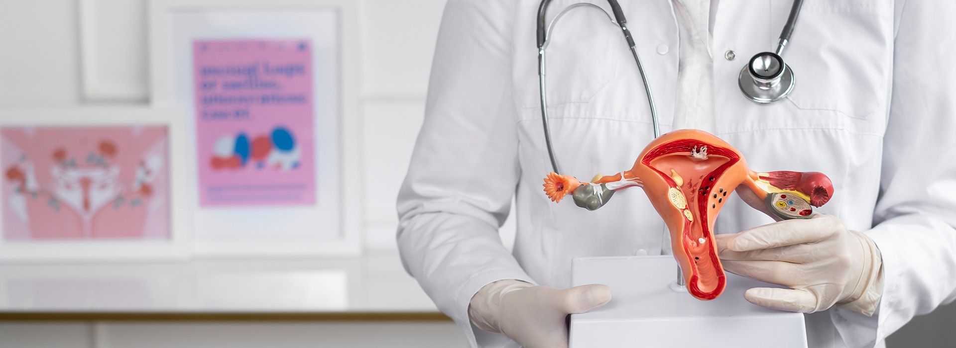 Polikistik Over Sendromu