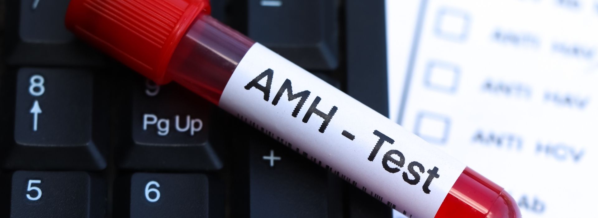 AMH D&uuml;ş&uuml;kl&uuml;ğ&uuml; ve T&uuml;p Bebek Tedavisi